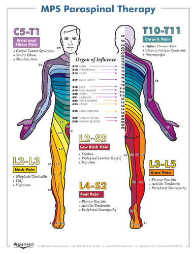 Free Pain Poster Offer MPS Courses Free Pain Poster Offer MPS Courses