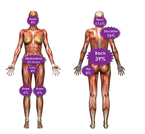 c section belt side effects